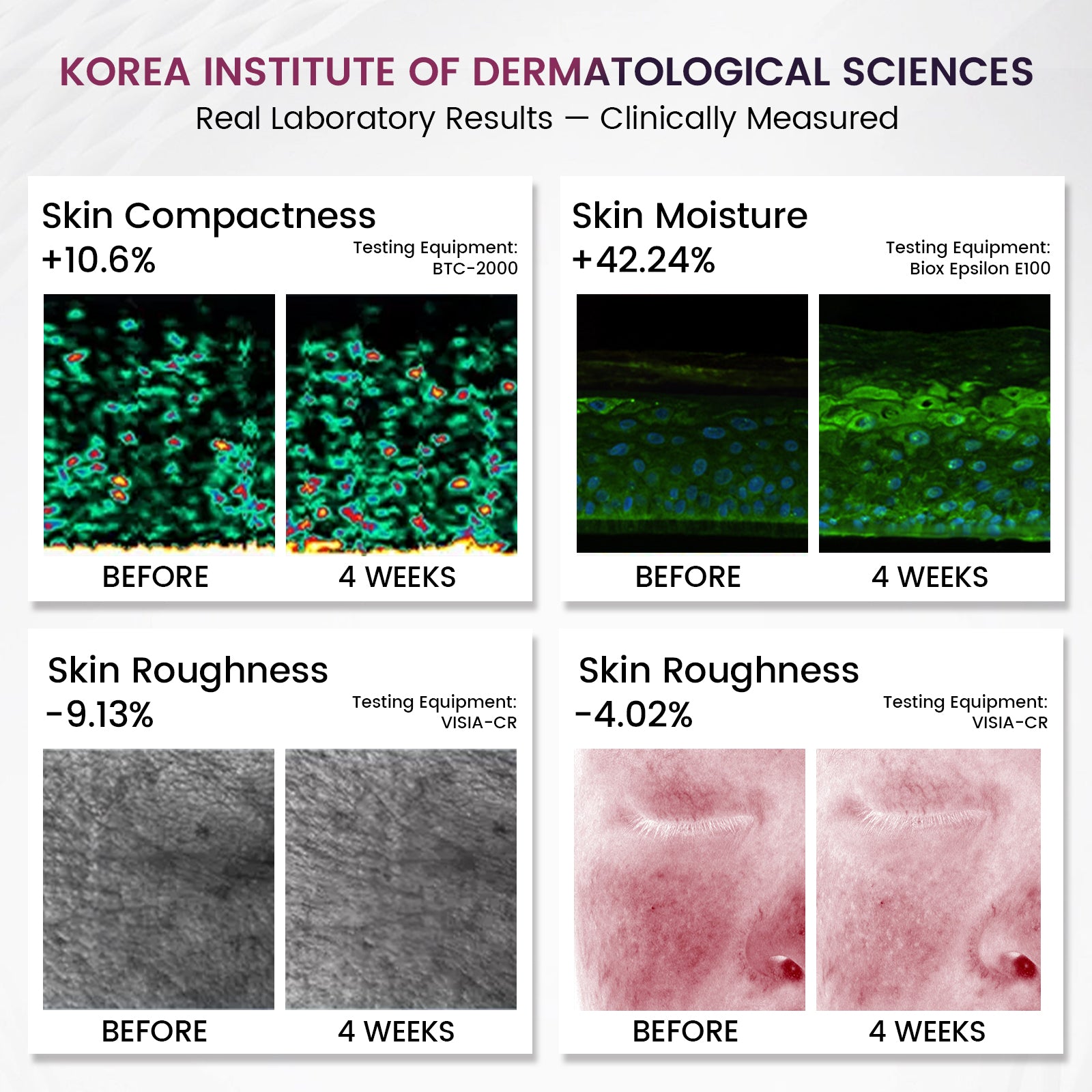 Red Light Therapy Mask for Face – 8 Light Modes with 850nm Near-Infrared, 280 LED Face Mask Light Therapy for Skin Appearance, Fine Lines, Firming Support, FDA Cleared, Cordless Design